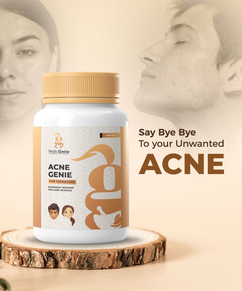 Acne Genie – Say Bye Bye to your Unwanted Acne